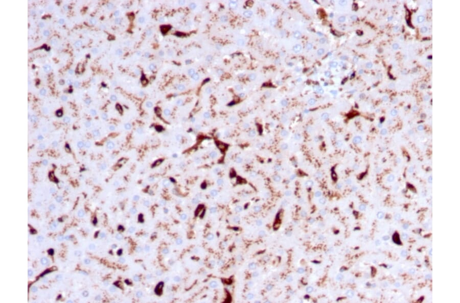Immunohistochemistry - Anti-Cathepsin K Antibody [CTSK/2792] (A248310) - Antibodies.com