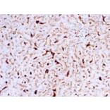 Immunohistochemistry - Anti-Cathepsin K Antibody [CTSK/2792] (A248310) - Antibodies.com