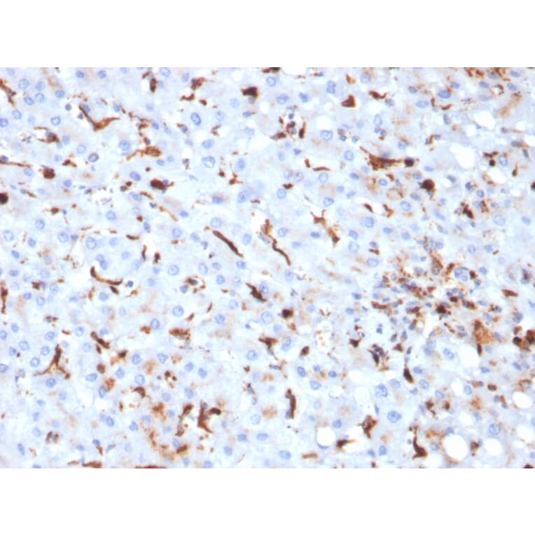 Immunohistochemistry - Anti-Cathepsin K Antibody [CTSK/2793] (A248311) - Antibodies.com