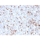 Immunohistochemistry - Anti-Cathepsin K Antibody [CTSK/2793] (A248311) - Antibodies.com