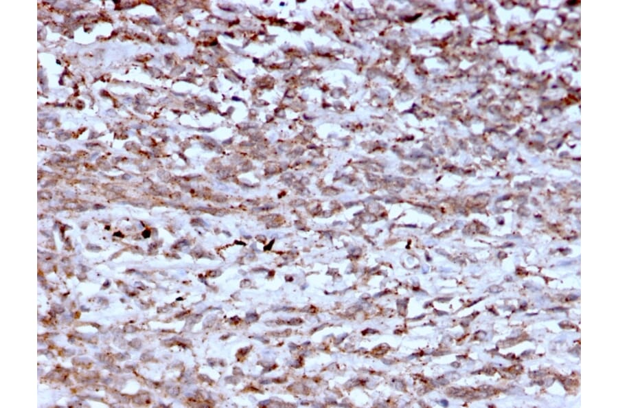 Immunohistochemistry - Anti-Cathepsin K Antibody [CTSK/2793] (A248311) - Antibodies.com
