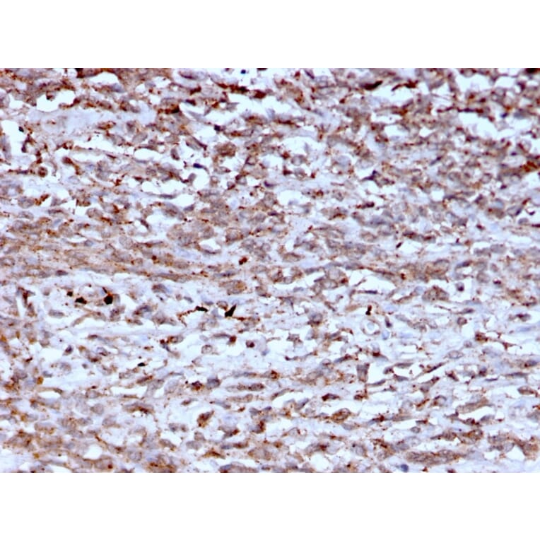 Immunohistochemistry - Anti-Cathepsin K Antibody [CTSK/2793] (A248311) - Antibodies.com