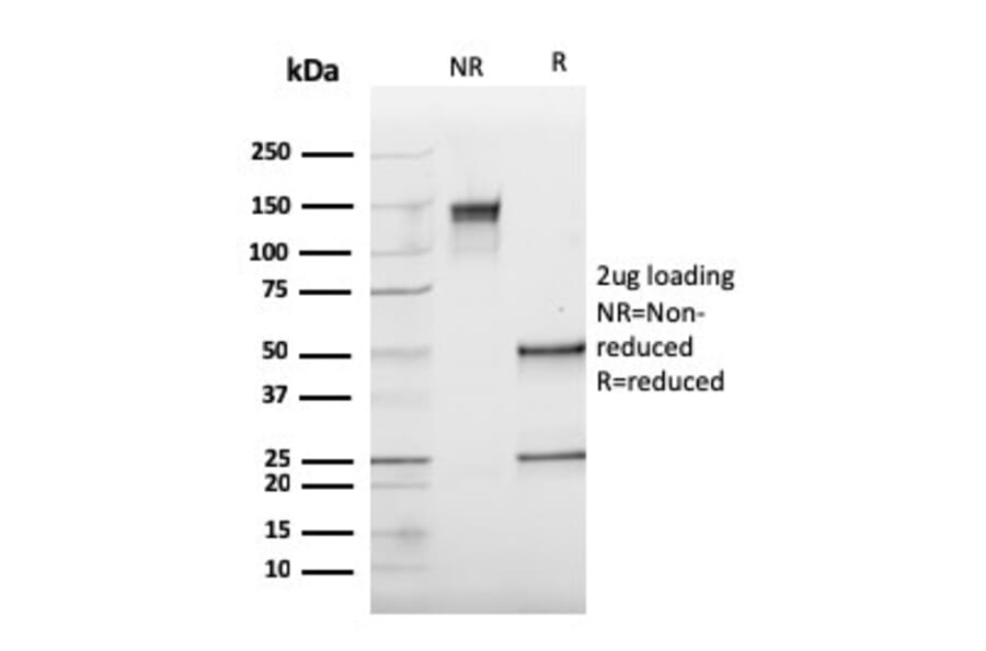 SDS-PAGE - Anti-Cathepsin K Antibody [CTSK/2793] (A248311) - Antibodies.com