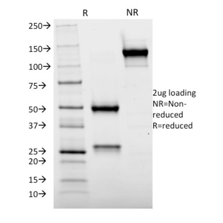 SDS-PAGE - Anti-Cytochrome p450 Antibody [M12P4H2] (A248314) - Antibodies.com