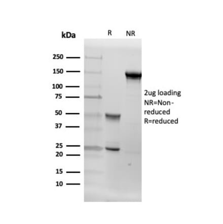 SDS-PAGE - Anti-Aromatase Antibody [CYP19A1/4257] (A248315) - Antibodies.com