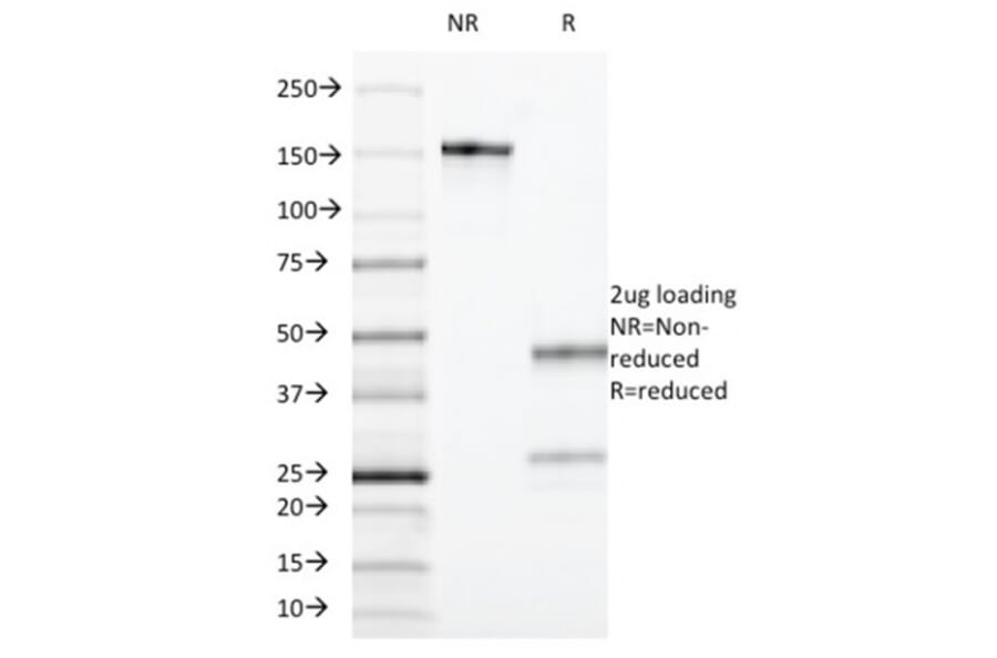 SDS-PAGE - Anti-CD55 Antibody [F4-29D9] (A248316) - Antibodies.com
