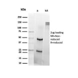 SDS-PAGE - Anti-DAXX Antibody [PCRP-DAXX-8C2] (A248319) - Antibodies.com