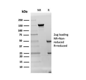 SDS-PAGE - Anti-DAZL Antibody [DAZL/4253] (A248320) - Antibodies.com