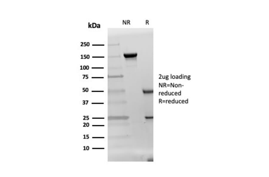 SDS-PAGE - Anti-DAZL Antibody [DAZL/4253] (A248320) - Antibodies.com