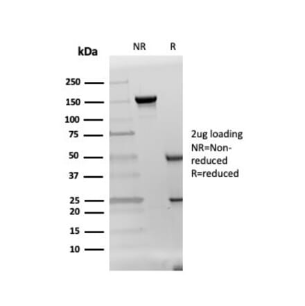 SDS-PAGE - Anti-DAZL Antibody [DAZL/4253] (A248320) - Antibodies.com