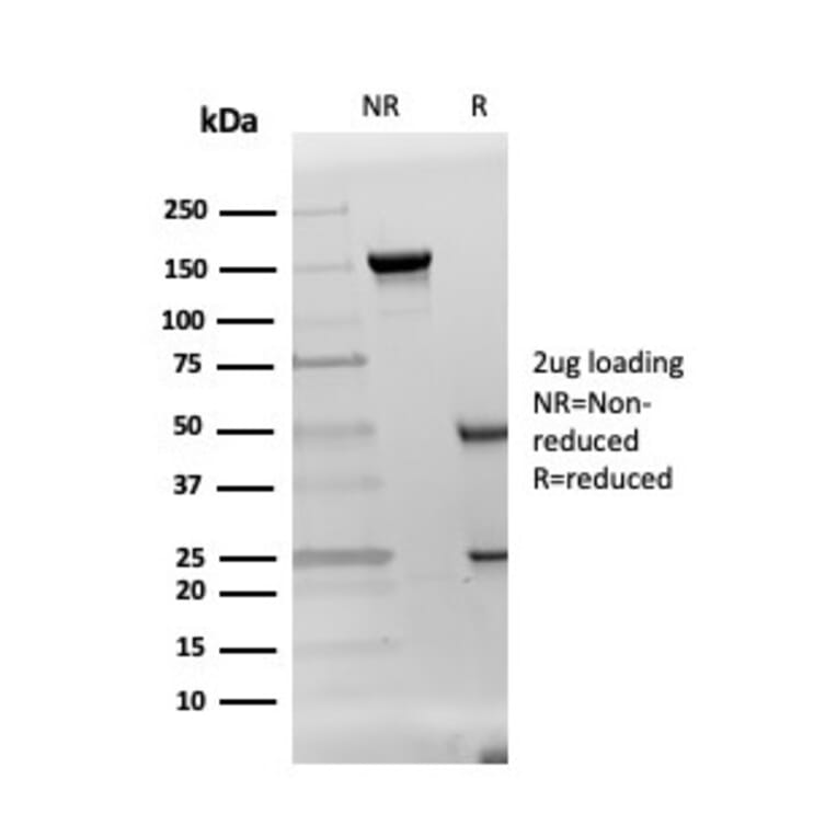 SDS-PAGE - Anti-DAZL Antibody [DAZL/4253] (A248320) - Antibodies.com