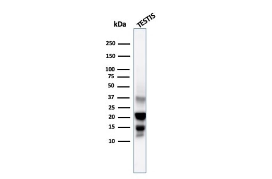Western Blot - Anti-DAZL Antibody [DAZL/4253] (A248320) - Antibodies.com