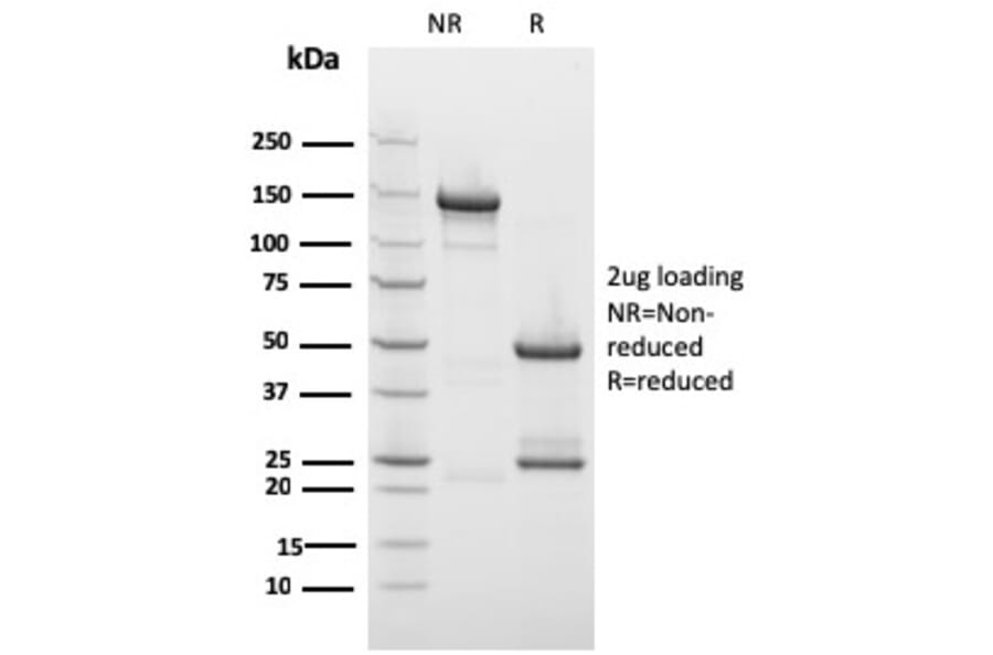 SDS-PAGE - Anti-Drebrin Antibody [DBN1/2879] (A248321) - Antibodies.com