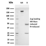 SDS-PAGE - Anti-Drebrin Antibody [DBN1/2880] (A248322) - Antibodies.com