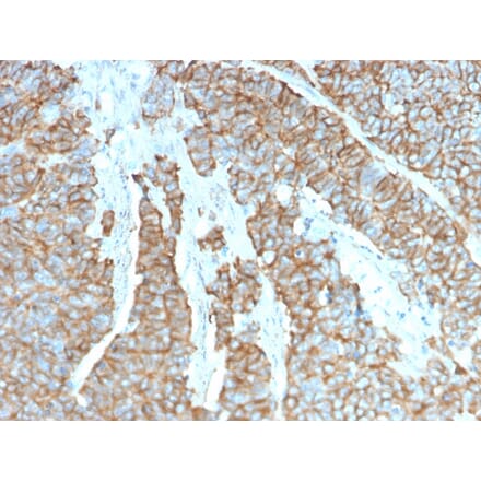 Immunohistochemistry - Anti-Drebrin Antibody [DBN1/3393] (A248323) - Antibodies.com