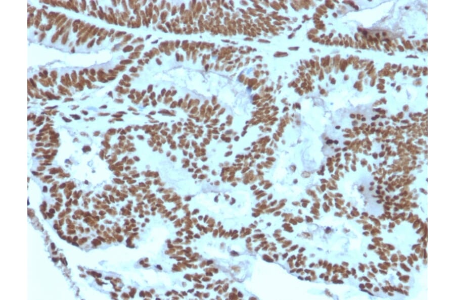 Immunohistochemistry - Anti-ZNF846 Antibody [ZNF846/2687] (A248324) - Antibodies.com