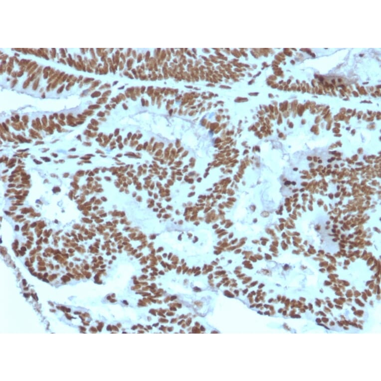 Immunohistochemistry - Anti-ZNF846 Antibody [ZNF846/2687] (A248324) - Antibodies.com