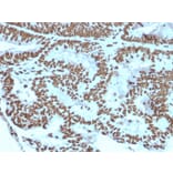 Immunohistochemistry - Anti-ZNF846 Antibody [ZNF846/2687] (A248324) - Antibodies.com