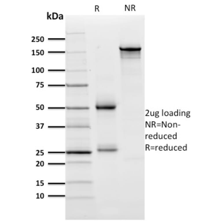 SDS-PAGE - Anti-ZNF846 Antibody [ZNF846/2687] (A248324) - Antibodies.com