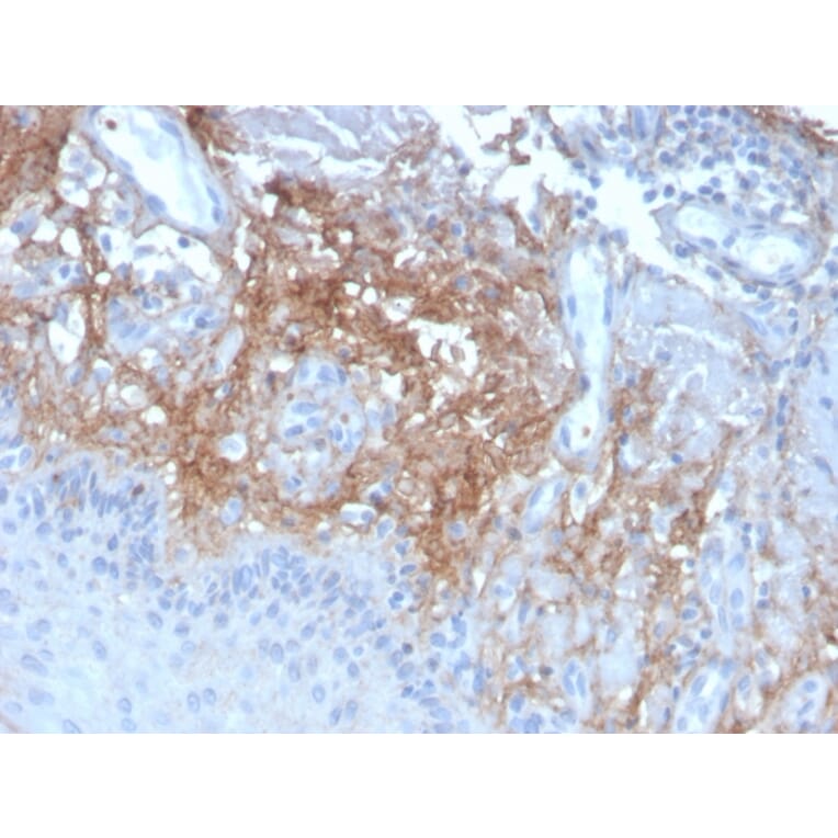 Immunohistochemistry - Anti-Decorin Antibody [DCN/3523] (A248325) - Antibodies.com