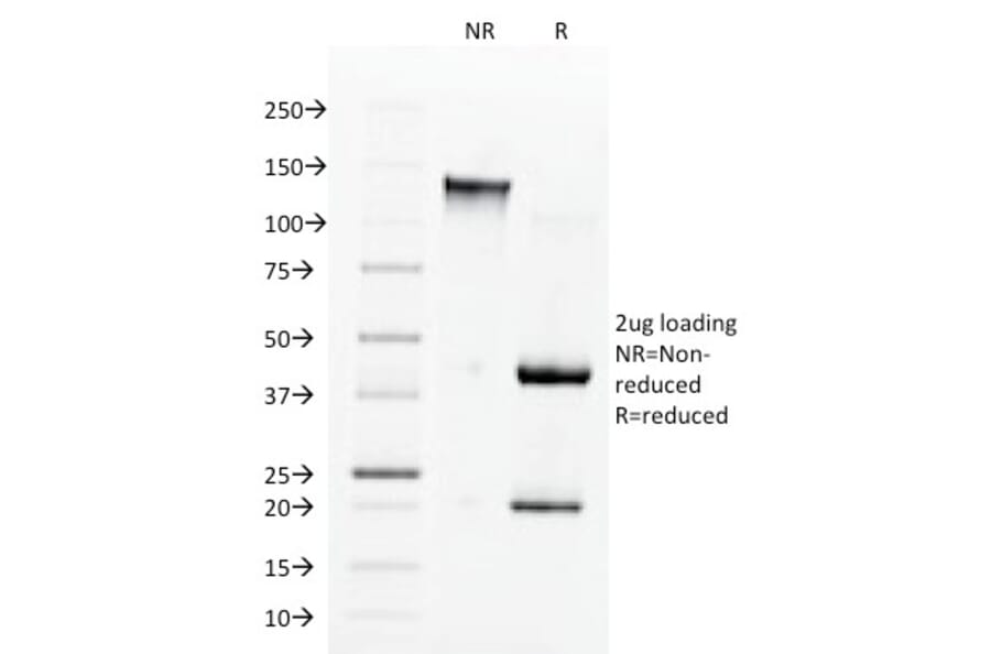 SDS-PAGE - Anti-Angiotensin Converting Enzyme 1 Antibody [9B9] (A248325) - Antibodies.com