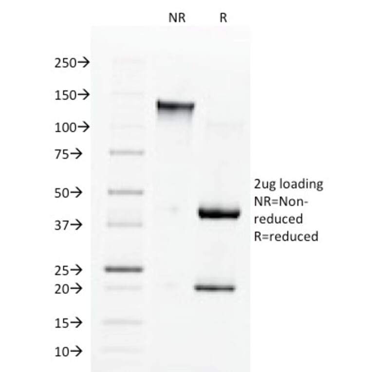SDS-PAGE - Anti-Angiotensin Converting Enzyme 1 Antibody [9B9] (A248325) - Antibodies.com