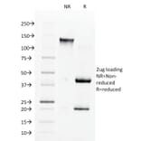 SDS-PAGE - Anti-Angiotensin Converting Enzyme 1 Antibody [9B9] (A248325) - Antibodies.com
