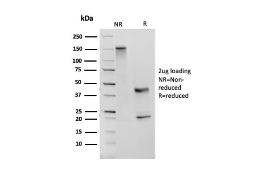 SDS-PAGE - Anti-Angiotensin Converting Enzyme 1 Antibody [ACE/3763] (A248328) - Antibodies.com