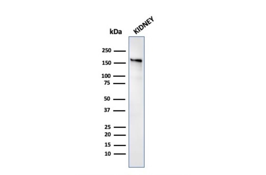 Western Blot - Anti-Angiotensin Converting Enzyme 1 Antibody [ACE/3763] (A248328) - Antibodies.com