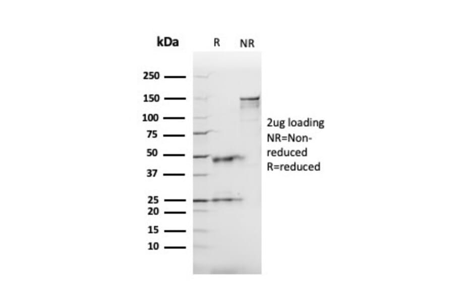 SDS-PAGE - Anti-Angiotensin Converting Enzyme 1 Antibody [ACE/3765] (A248329) - Antibodies.com