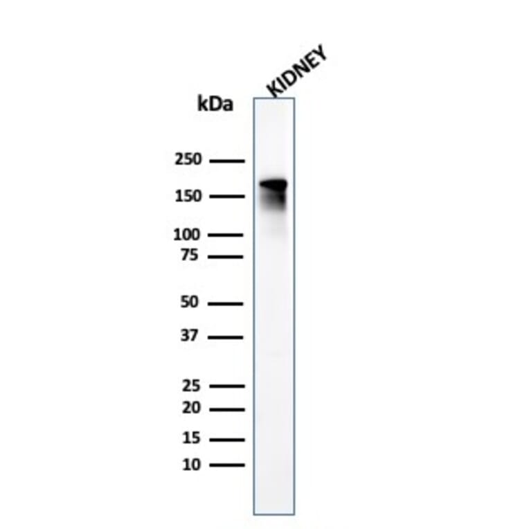 Western Blot - Anti-Angiotensin Converting Enzyme 1 Antibody [ACE/3765] (A248329) - Antibodies.com