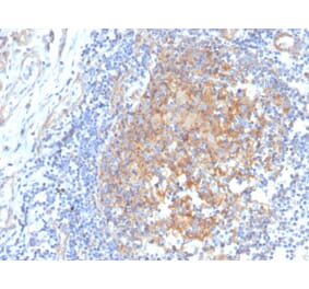 Immunohistochemistry - Anti-AKR1C1 Antibody [CPTC-AKR1C1-2] (A248330) - Antibodies.com