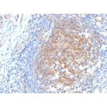 Immunohistochemistry - Anti-AKR1C1 Antibody [CPTC-AKR1C1-2] (A248330) - Antibodies.com