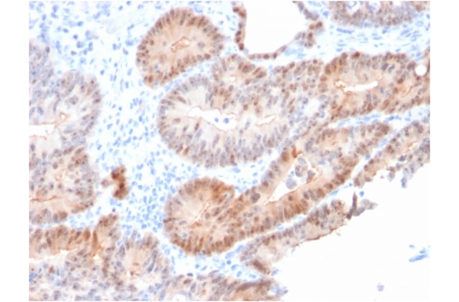 Immunohistochemistry - Anti-AKR1C2 Antibody [CPTC-AKR1C2-1] (A248331) - Antibodies.com