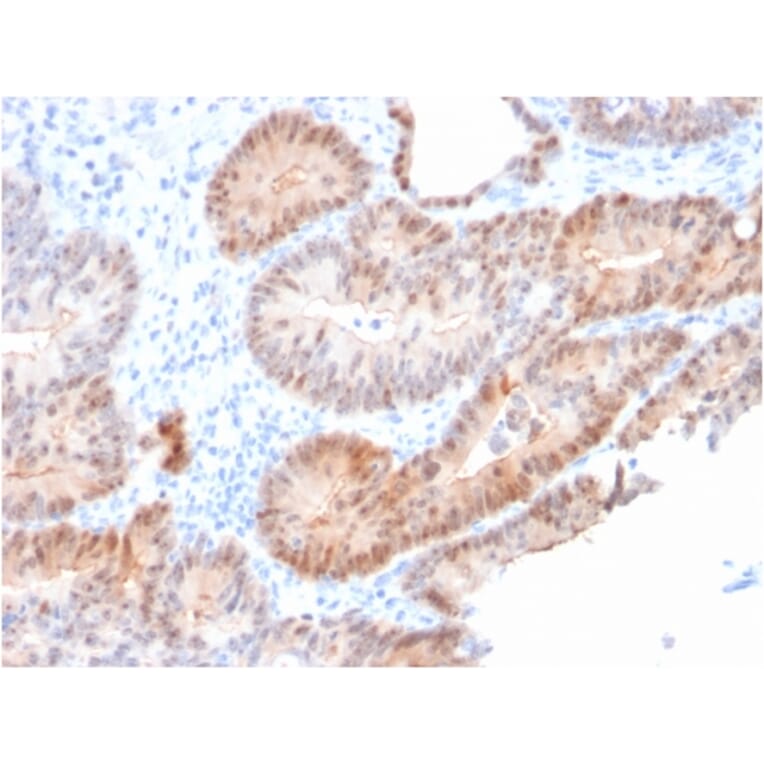 Immunohistochemistry - Anti-AKR1C2 Antibody [CPTC-AKR1C2-1] (A248331) - Antibodies.com