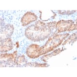 Immunohistochemistry - Anti-AKR1C2 Antibody [CPTC-AKR1C2-1] (A248331) - Antibodies.com