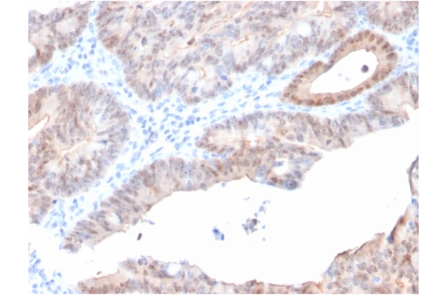 Immunohistochemistry - Anti-AKR1C2 Antibody [CPTC-AKR1C2-1] (A248331) - Antibodies.com
