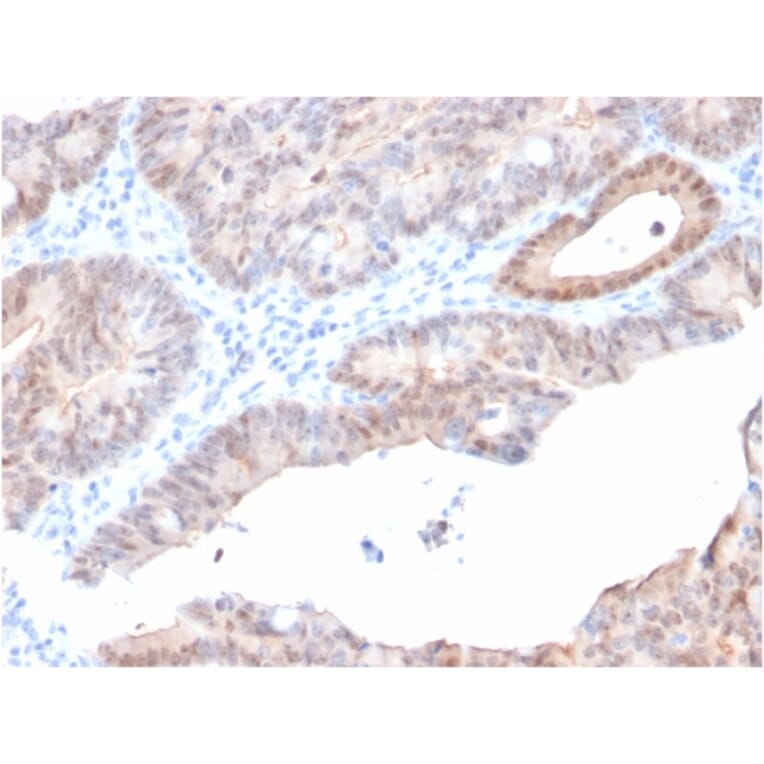 Immunohistochemistry - Anti-AKR1C2 Antibody [CPTC-AKR1C2-1] (A248331) - Antibodies.com