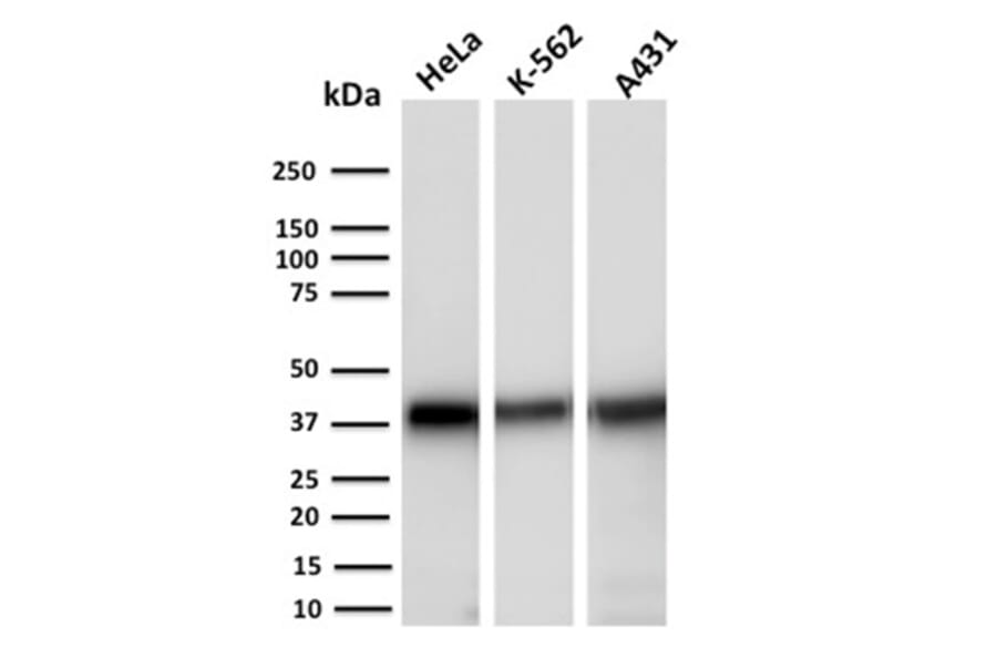 Western Blot - Anti-AKR1C2 Antibody [CPTC-AKR1C2-1] (A248331) - Antibodies.com