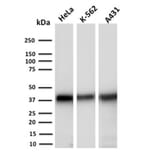 Western Blot - Anti-AKR1C2 Antibody [CPTC-AKR1C2-1] (A248331) - Antibodies.com