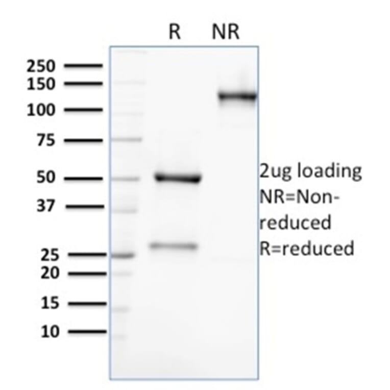 SDS-PAGE - Anti-AKR1C2 Antibody [CPTC-AKR1C2-1] (A248331) - Antibodies.com