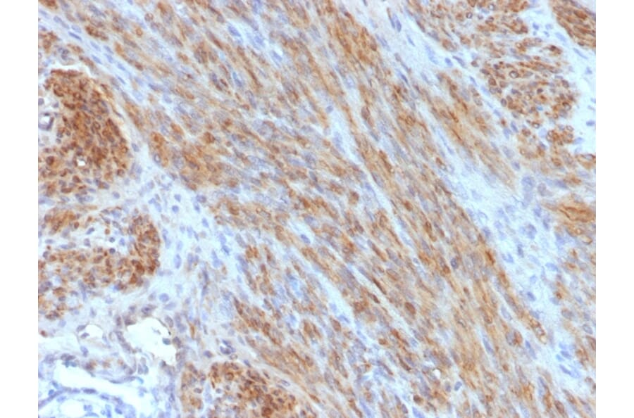 Immunohistochemistry - Anti-Desmin Antibody [DES/1711] (A248331) - Antibodies.com