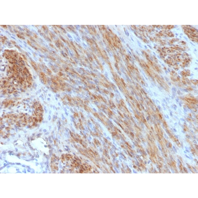 Immunohistochemistry - Anti-Desmin Antibody [DES/1711] (A248331) - Antibodies.com