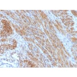 Immunohistochemistry - Anti-Desmin Antibody [DES/1711] (A248331) - Antibodies.com