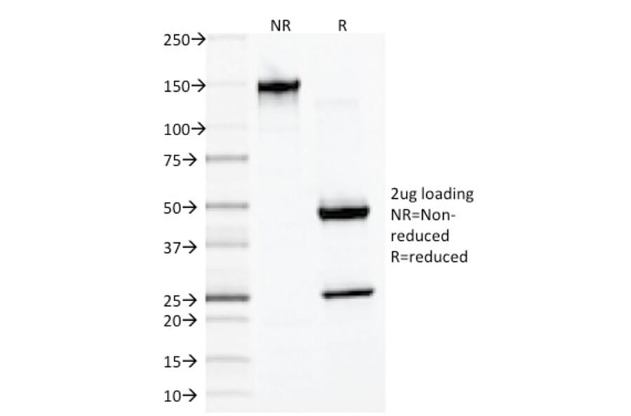 SDS-PAGE - Anti-Desmin Antibody [DES/1711] (A248332) - Antibodies.com
