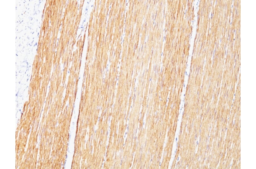 Immunohistochemistry - Anti-Desmin Antibody [D33] (A248332) - Antibodies.com