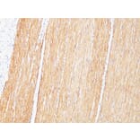 Immunohistochemistry - Anti-Desmin Antibody [D33] (A248332) - Antibodies.com