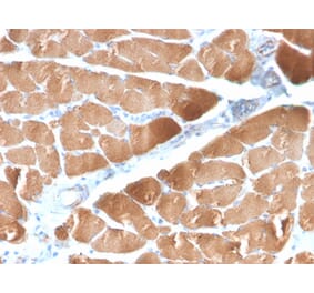 Immunohistochemistry - Anti-Desmin Antibody [DES/2960R] (A248333) - Antibodies.com