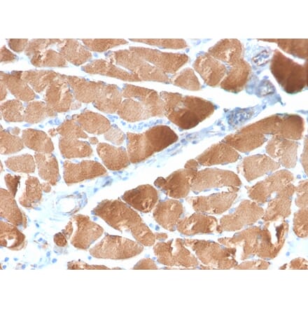 Immunohistochemistry - Anti-Desmin Antibody [DES/2960R] (A248333) - Antibodies.com