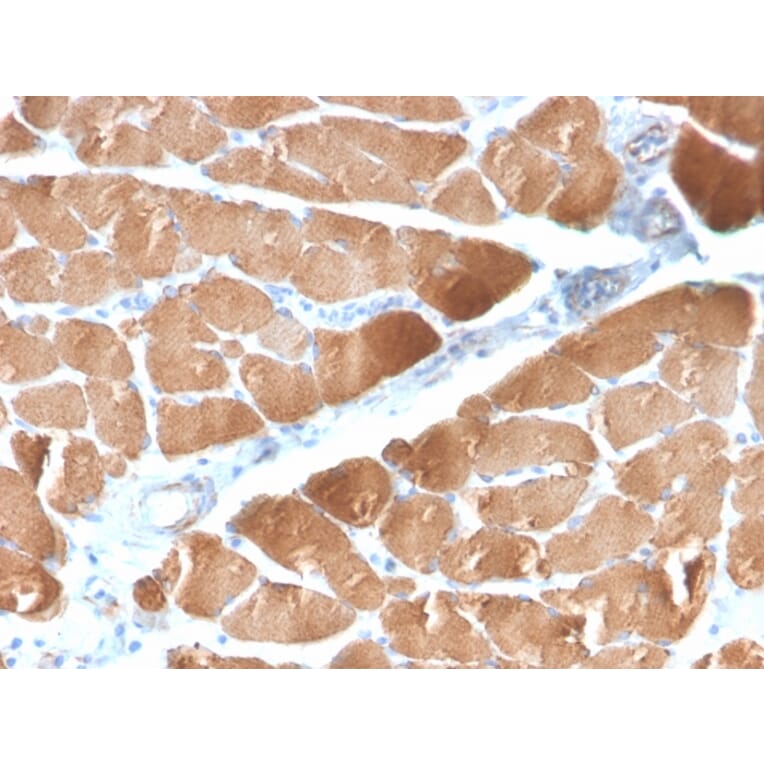 Immunohistochemistry - Anti-Desmin Antibody [DES/2960R] (A248333) - Antibodies.com